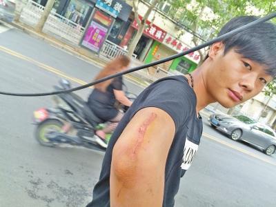 郑州骑电动车小伙被线缆勒住脖子挂翻 生命垂危